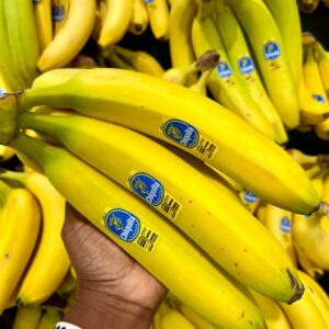 10 Incredible Health Benefits of Eating Bananas